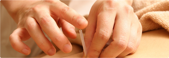 鍼灸治療についてご説明します