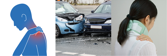 交通事故施術についてイメージ