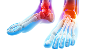 足関節の疾患イメージ